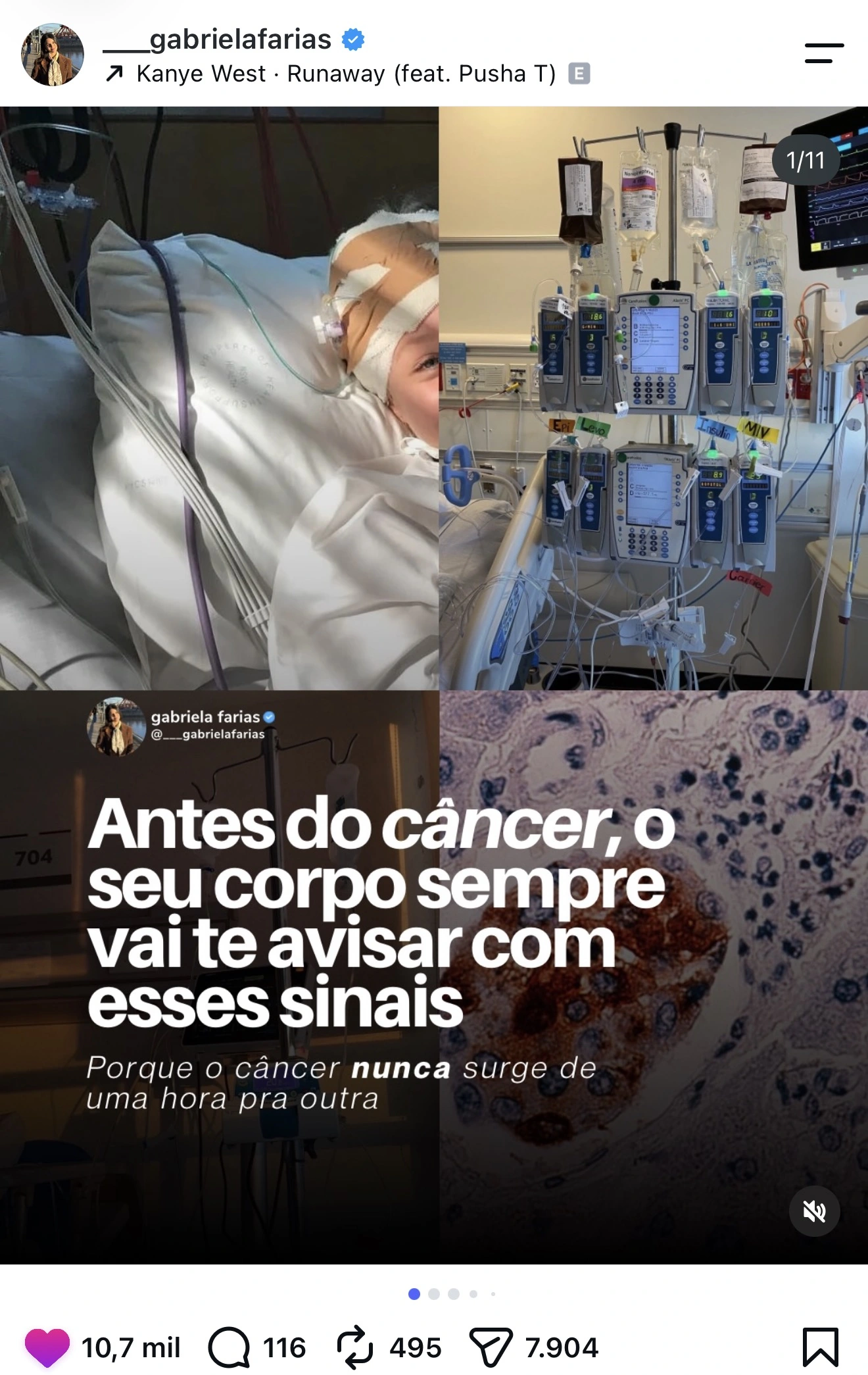 Post da Gabriela Farias com 10,7 mil curtidas: Antes do câncer, o seu corpo sempre vai te avisar com esses sinais
