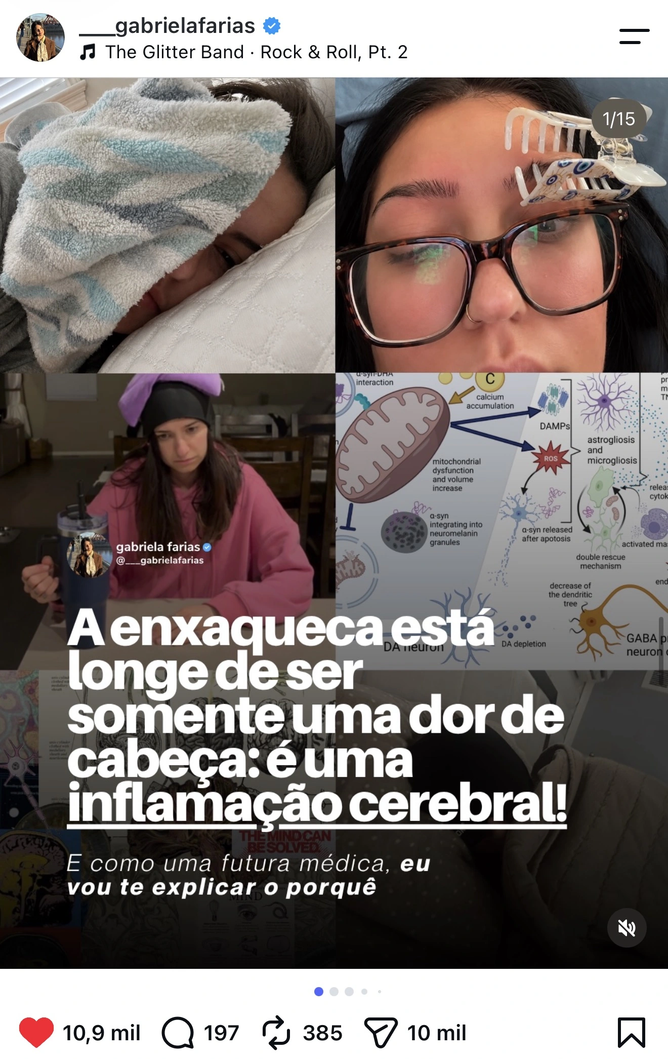 Post da Gabriela Farias com 10,9 mil curtidas: A enxaqueca está longe de ser somente uma dor de cabeça, é uma inflamação cerebral