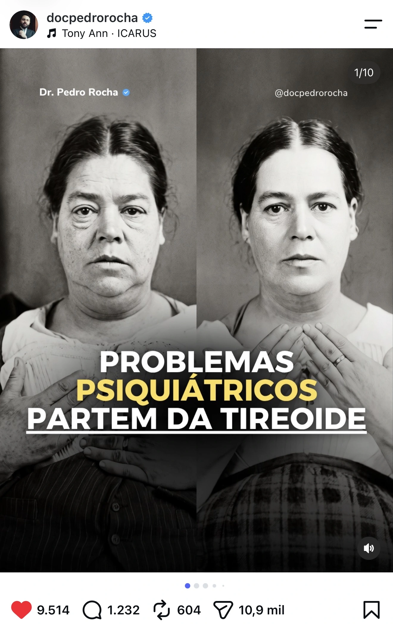 Resultado de Pedro Rocha . print original da publicação